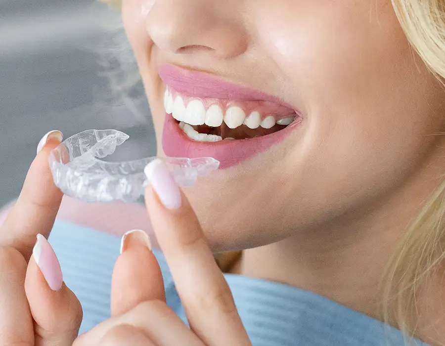 Allineatori invisibili per adulti - Studio dentistico a Brescia – Dott.ssa Irina Garaeva