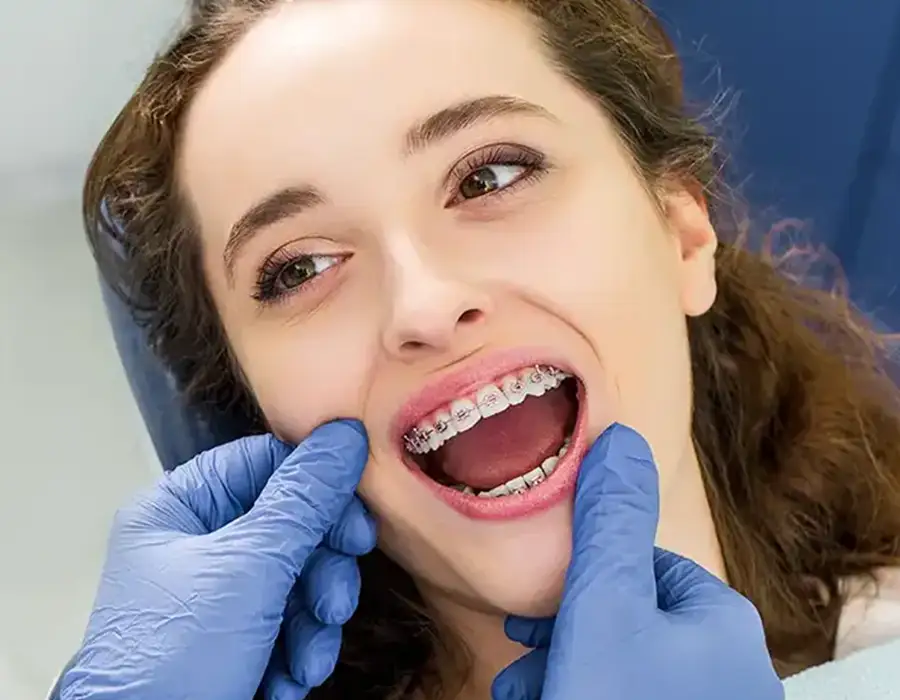 Apparecchi dentali su misura - Studio dentistico a Brescia – Dott.ssa Irina Garaeva