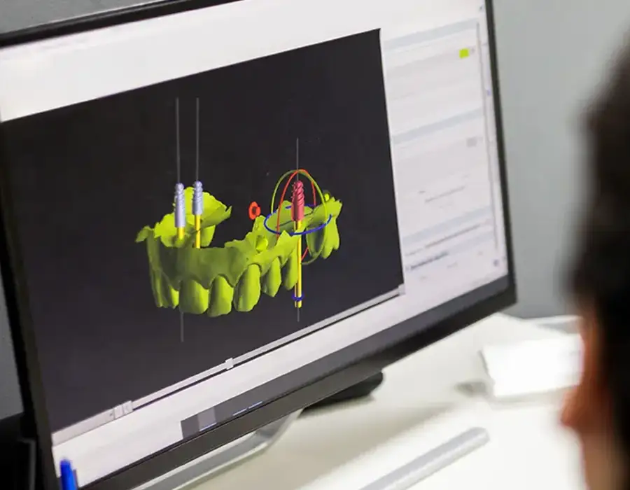 Chirurgia Orale - Tecnologie - Studio dentistico a Brescia – Dott.ssa Irina Garaeva