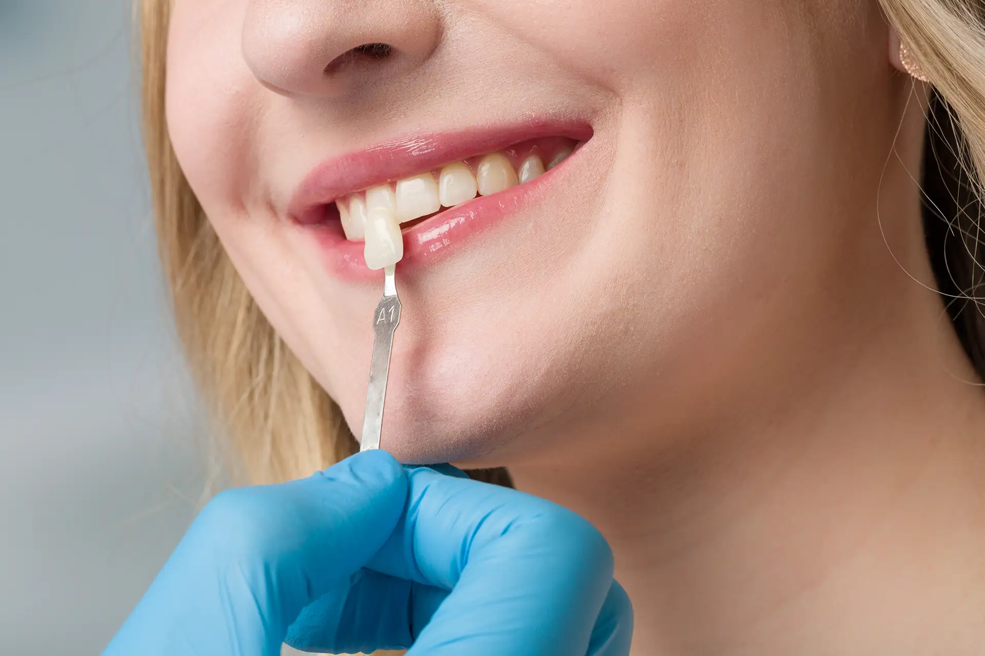 Chirurgia Orale - Studio dentistico a Brescia – Dott.ssa Irina Garaeva