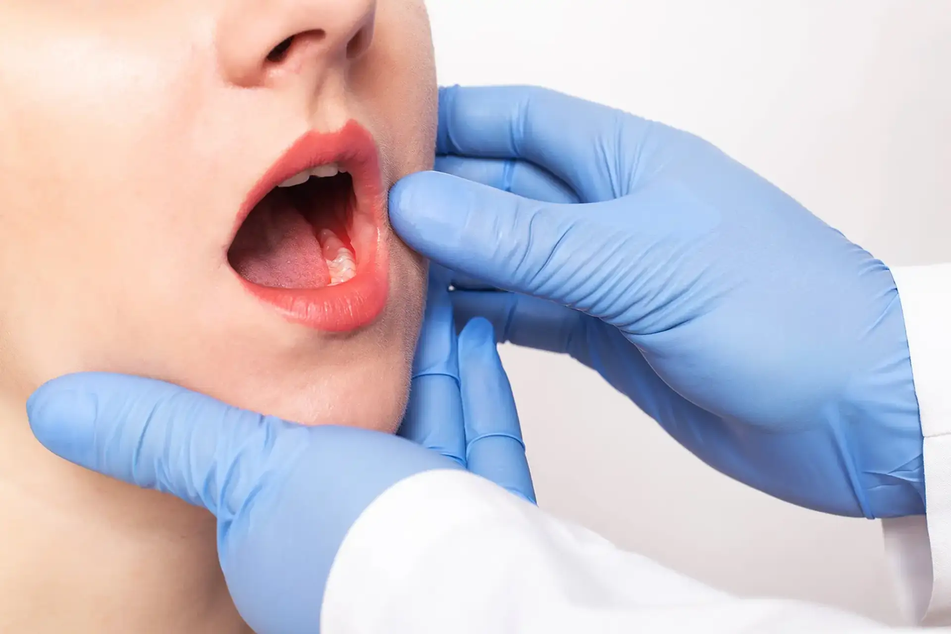 Gnatologia - Studio dentistico a Brescia – Dott.ssa Irina Garaeva