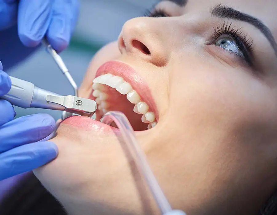Igiene orale professionale - Studio dentistico a Brescia – Dott.ssa Irina Garaeva
