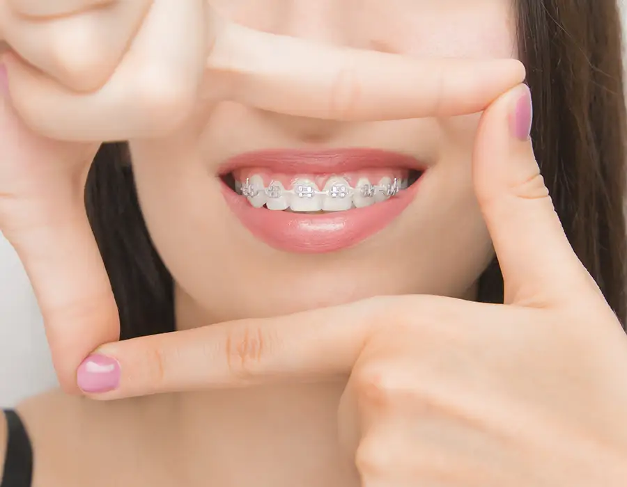 Ortodonzia adulti - Studio dentistico a Brescia – Dott.ssa Irina Garaeva