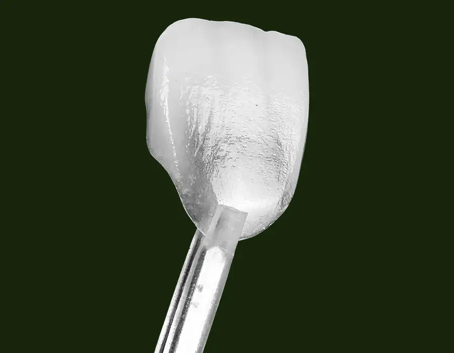 Perché scegliere le faccette dentali - Studio dentistico a Brescia – Dott.ssa Irina Garaeva