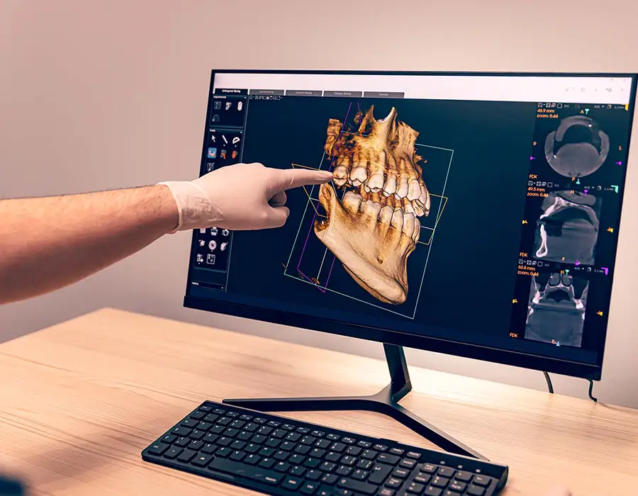 Tecnologie per le faccette dentali - Studio dentistico a Brescia – Dott.ssa Irina Garaeva