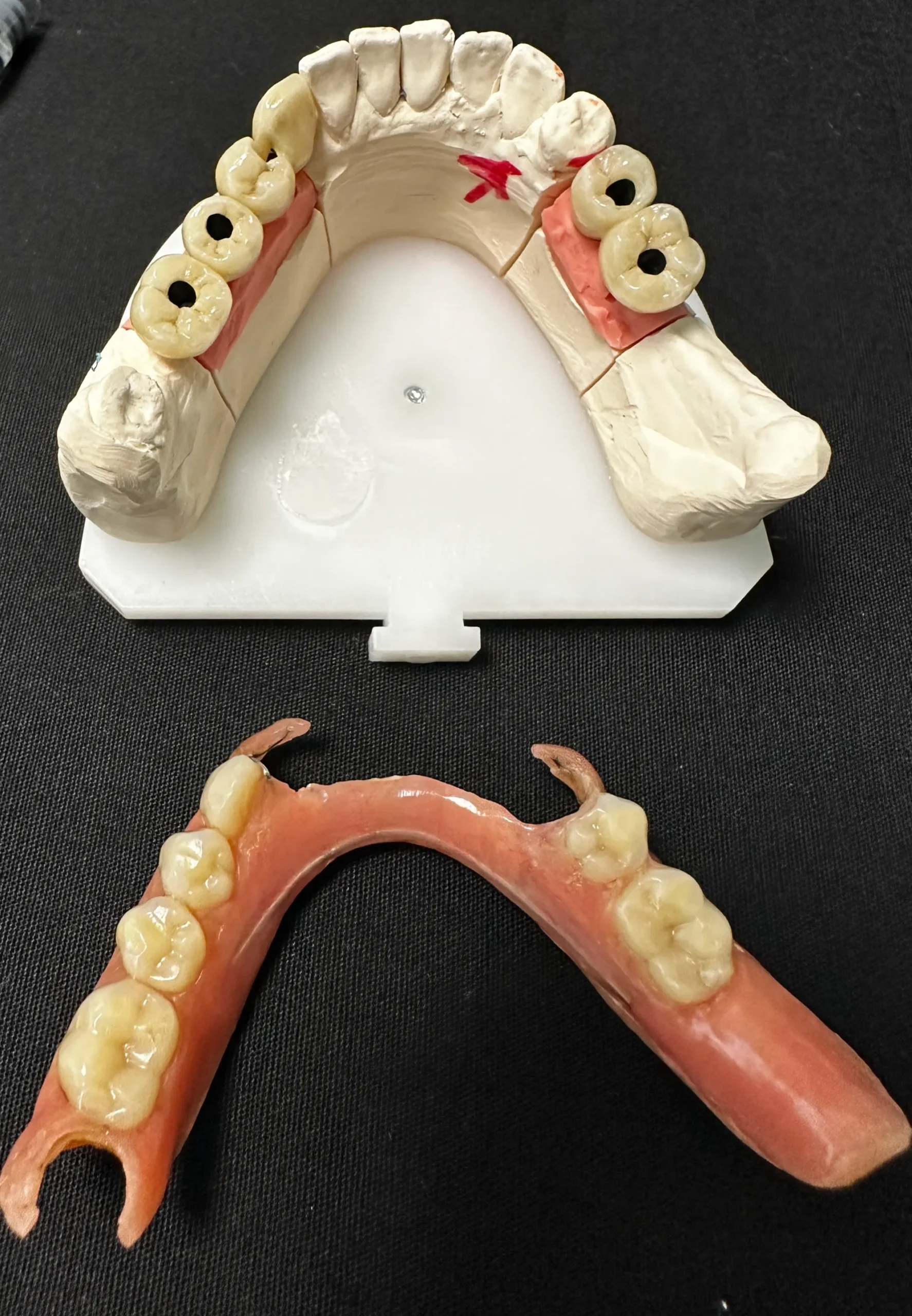 Protesi mobile - Studio dentistico a Brescia – Dott.ssa Irina Garaeva