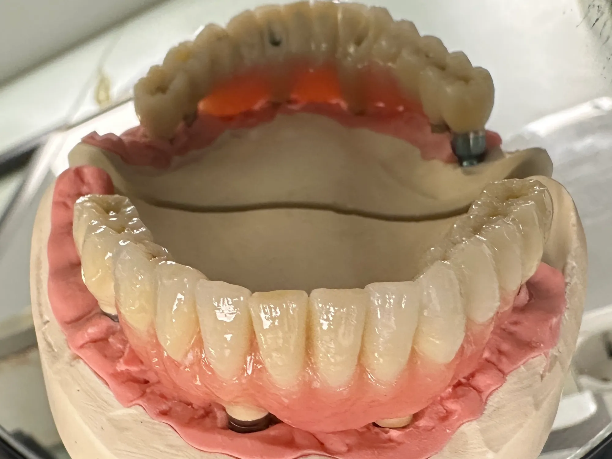 Gnatologia - Studio dentistico a Brescia – Dott.ssa Irina Garaeva