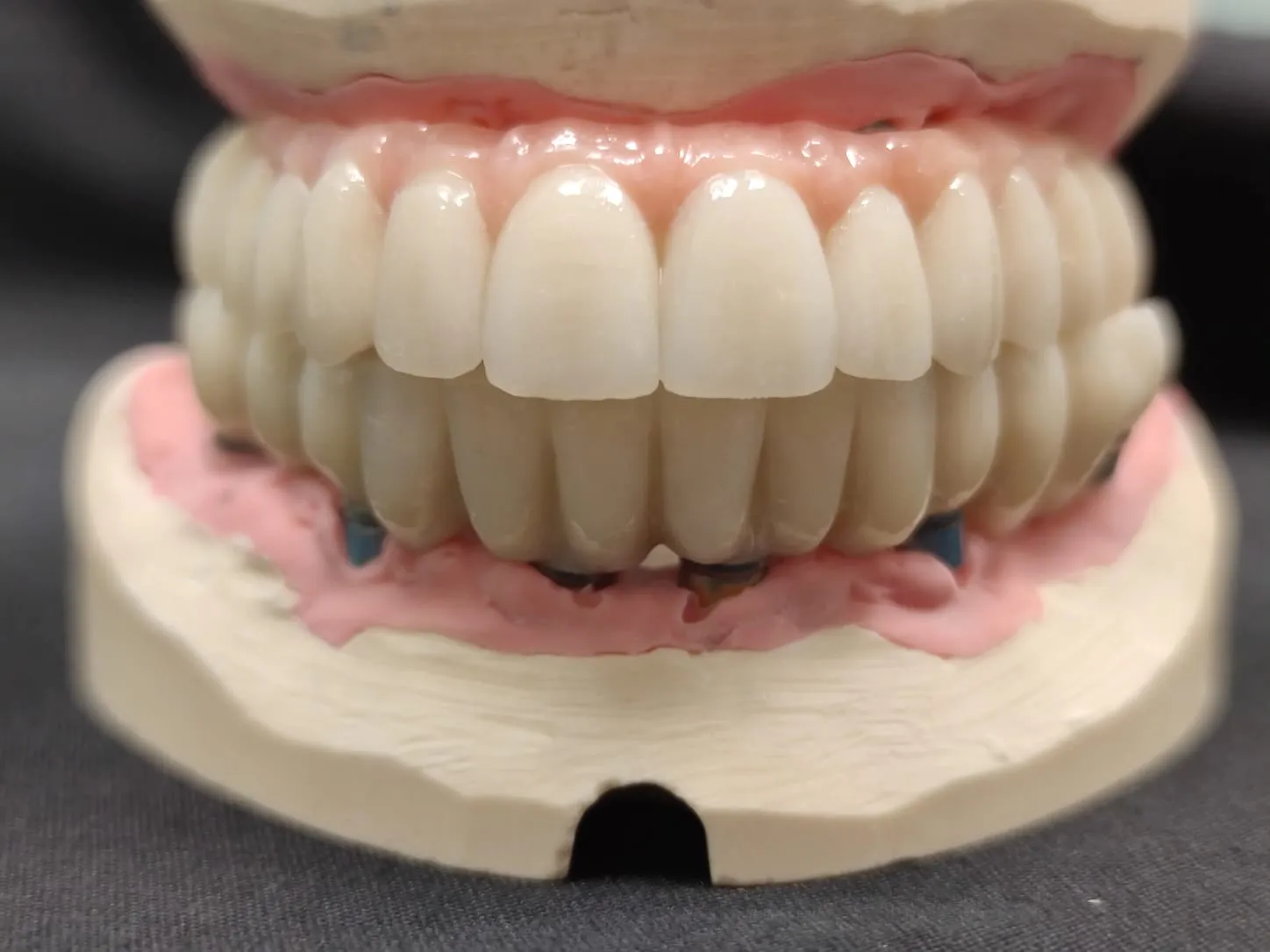 Un trattamento personalizzato, una nuova qualità di vita - Studio dentistico a Brescia – Dott.ssa Irina Garaeva